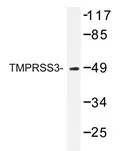 TMPRSS3 Rabbit Polyclonal Antibody - image 1