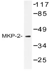 DUSP4 Rabbit Polyclonal Antibody - image 1