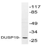 DUSP19 Rabbit Polyclonal Antibody - image 1