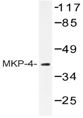 DUSP9 Rabbit Polyclonal Antibody - image 1