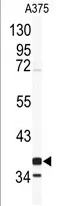 Cathepsin K (CTSK) Rabbit Polyclonal Antibody - image 1