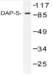 DAP5 (EIF4G2) Rabbit Polyclonal Antibody - image 1