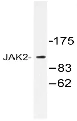 JAK2 Rabbit Polyclonal Antibody - image 1