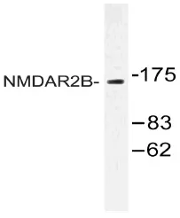 NMDAR2B (GRIN2B) Rabbit Polyclonal Antibody - image 1