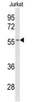 Cytochrome p450 2C19 (CYP2C19) Rabbit Polyclonal Antibody - image 1