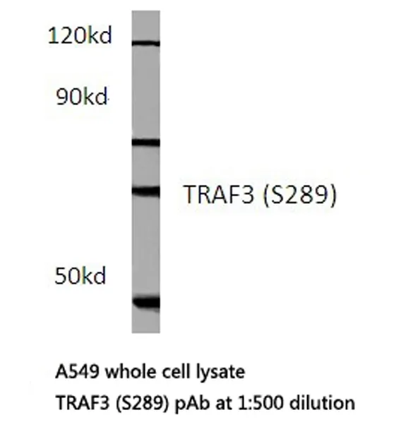 TCF3 / E2A (TCF3) Rabbit Polyclonal Antibody - image 1