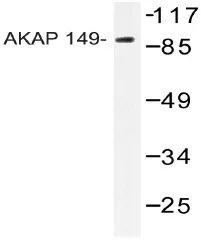 AKAP1 Rabbit Polyclonal Antibody - image 1