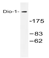 DATF1 (DIDO1) Rabbit Polyclonal Antibody - image 1