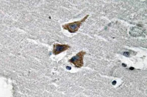 uPA (PLAU) Rabbit Polyclonal Antibody - image 1