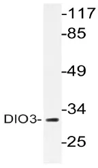 DIO3 Rabbit Polyclonal Antibody - image 1