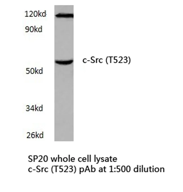 SRC Rabbit Polyclonal Antibody - image 1