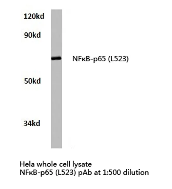 NF-kB p65 (RELA) Rabbit Polyclonal Antibody - image 1