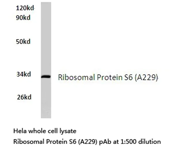 RPS6 Rabbit Polyclonal Antibody - image 1