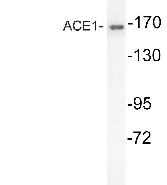 Angiotensin Converting Enzyme 1 (ACE) Rabbit Polyclonal Antibody - image 1