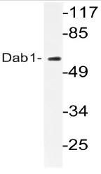 DAB1 Rabbit Polyclonal Antibody - image 1