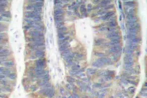 PKR (EIF2AK2) Rabbit Polyclonal Antibody - image 1