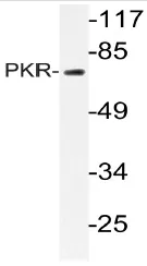 PKR (EIF2AK2) Rabbit Polyclonal Antibody - image 1