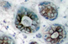 GAP43 Rabbit Polyclonal Antibody - image 1