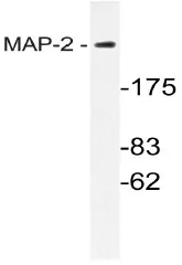 MAP2 Rabbit Polyclonal Antibody - image 1