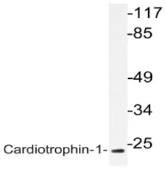 Cardiotrophin 1 (CTF1) Rabbit Polyclonal Antibody - image 1