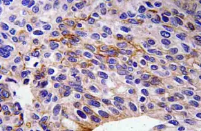 Semaphorin 3A (SEMA3A) Rabbit Polyclonal Antibody - image 1