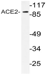 Angiotensin Converting Enzyme 2 (ACE2) Rabbit Polyclonal Antibody - image 1
