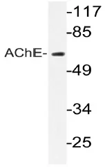 Acetylcholinesterase (ACHE) Rabbit Polyclonal Antibody - image 1