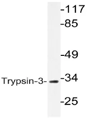 Trypsin (PRSS3) Rabbit Polyclonal Antibody - image 1