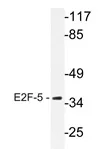 E2F5 Rabbit Polyclonal Antibody - image 1