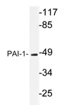 PAI1 (SERPINE1) Rabbit Polyclonal Antibody - image 1