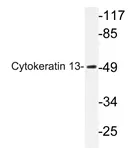 KRT13 Rabbit Polyclonal Antibody - image 1