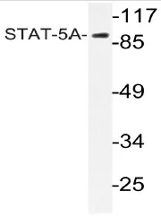 STAT5A Rabbit Polyclonal Antibody - image 1