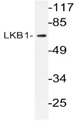 LKB1 (STK11) Rabbit Polyclonal Antibody - image 1