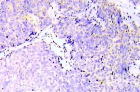 EIF4EBP1 Rabbit Polyclonal Antibody - image 1