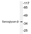 beta Sarcoglycan (SGCB) Rabbit Polyclonal Antibody - image 1