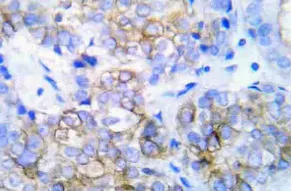 Her2 (ERBB2) Rabbit Polyclonal Antibody - image 1