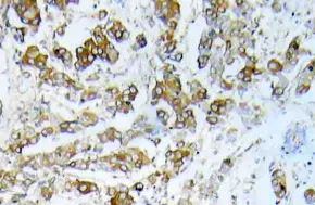 HSP27 (HSPB1) Rabbit Polyclonal Antibody - image 1