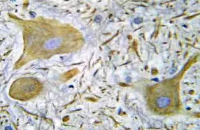 NMDAR1 (GRIN1) Rabbit Polyclonal Antibody - image 1