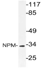 Nucleophosmin (NPM1) Rabbit Polyclonal Antibody - image 1