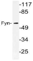 FYN Rabbit Polyclonal Antibody - image 1