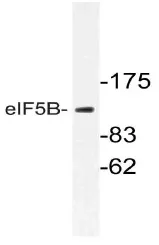 EIF5B Rabbit Polyclonal Antibody - image 1