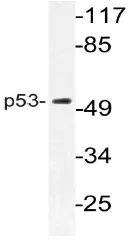 p53 (TP53) Rabbit Polyclonal Antibody - image 1