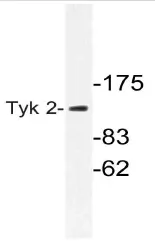 TYK2 Rabbit Polyclonal Antibody - image 1