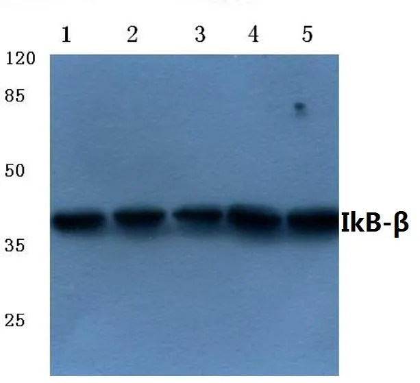 IKB beta (NFKBIB) Rabbit Polyclonal Antibody - image 1