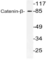 beta Catenin (CTNNB1) Rabbit Polyclonal Antibody - image 1