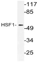 HSF1 Rabbit Polyclonal Antibody - image 1