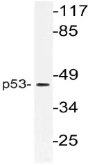 p53 (TP53) Rabbit Polyclonal Antibody - image 1