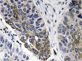 Human IgA Rabbit Polyclonal Antibody - image 1