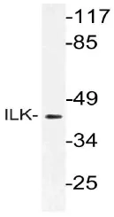 Integrin Linked Kinase (ILK) Rabbit Polyclonal Antibody - image 1