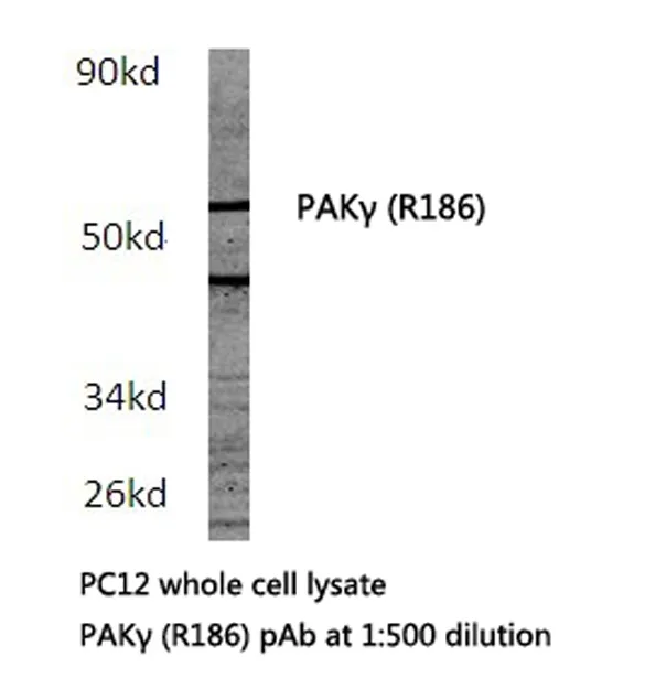 PAK2 Rabbit Polyclonal Antibody - image 1